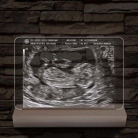 Magzati-ultrahangkép gravírozás fatalppal 7 színű 3D led lámpa