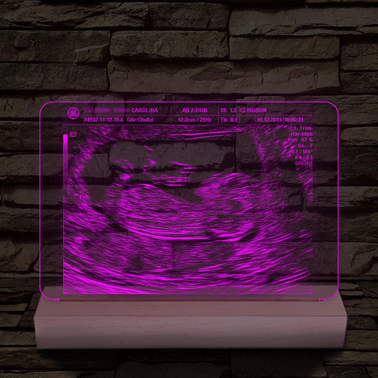 Magzati-ultrahangkép gravírozás fatalppal 7 színű 3D led lámpa