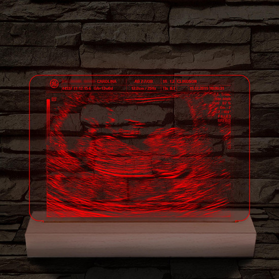 Magzati-ultrahangkép gravírozás fatalppal 7 színű 3D led lámpa