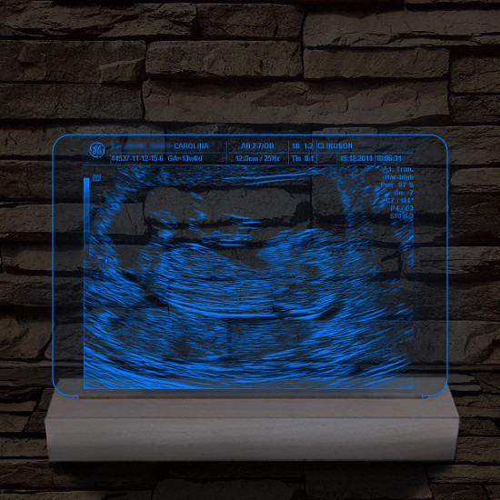 Magzati-ultrahangkép gravírozás fatalppal 7 színű 3D led lámpa