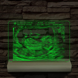 Magzati-ultrahangkép gravírozás fatalppal 7 színű 3D led lámpa