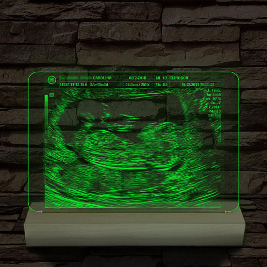Magzati-ultrahangkép gravírozás fatalppal 7 színű 3D led lámpa
